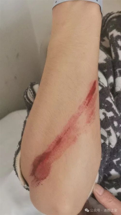 汽车门擦伤多少钱