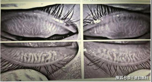 挤眉弄眼攻略游戏 VS projection游戏攻略
